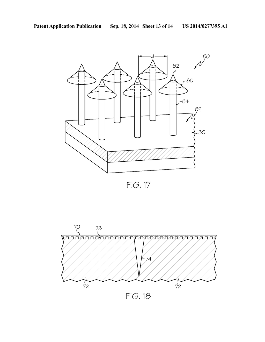 ANTI-MIGRATION MICROPATTERNED STENT COATING - diagram, schematic, and image 14