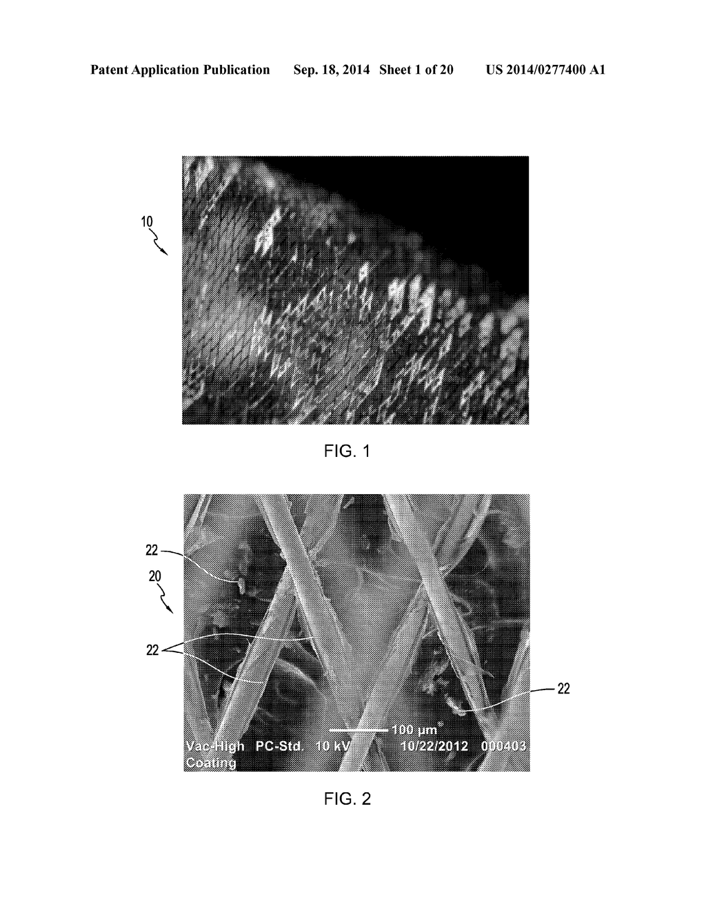 COATED MEDICAL DEVICES AND METHODS OF MAKING AND USING SAME - diagram, schematic, and image 02