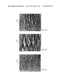 COATED MEDICAL DEVICES AND METHODS OF MAKING AND USING SAME diagram and image