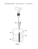 COATED MEDICAL DEVICES AND METHODS OF MAKING AND USING SAME diagram and image