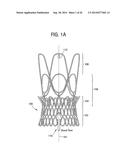 STENTS, VALVED-STENTS AND METHODS AND SYSTEMS FOR DELIVERY THEREOF diagram and image