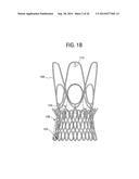 STENTS, VALVED-STENTS AND METHODS AND SYSTEMS FOR DELIVERY THEREOF diagram and image