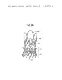 STENTS, VALVED-STENTS AND METHODS AND SYSTEMS FOR DELIVERY THEREOF diagram and image