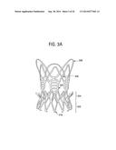 STENTS, VALVED-STENTS AND METHODS AND SYSTEMS FOR DELIVERY THEREOF diagram and image