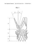 STENTS, VALVED-STENTS AND METHODS AND SYSTEMS FOR DELIVERY THEREOF diagram and image