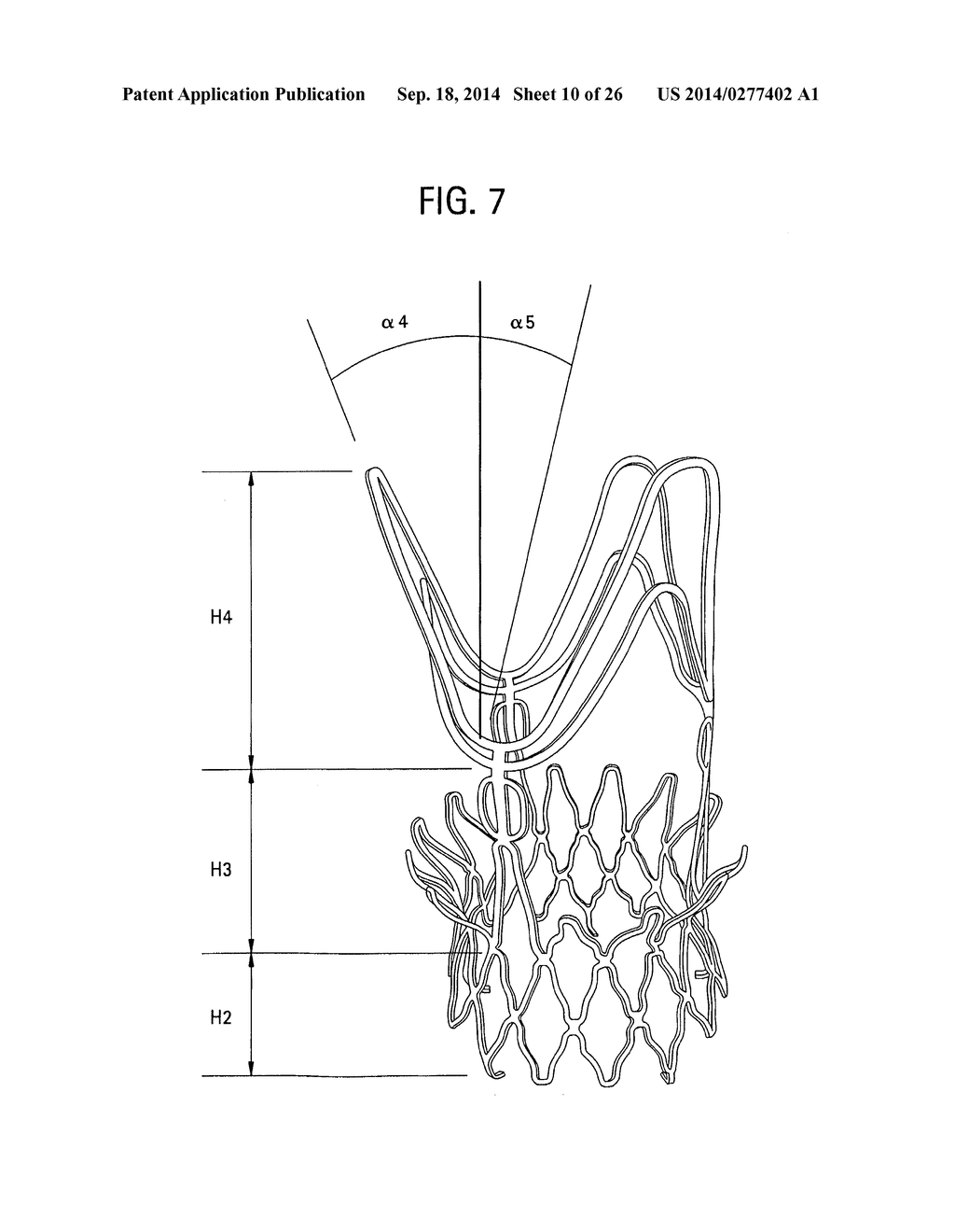 STENTS, VALVED-STENTS AND METHODS AND SYSTEMS FOR DELIVERY THEREOF - diagram, schematic, and image 11
