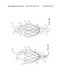 Devices and Methods for Preparing A Transcatheter Heart Valve System diagram and image