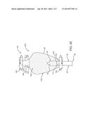 Devices and Methods for Preparing A Transcatheter Heart Valve System diagram and image