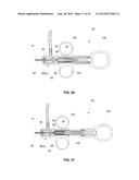 TRANS-APICAL IMPLANT SYSTEMS, IMPLANTS AND METHODS diagram and image