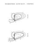 Prosthetic Heart Valve System diagram and image