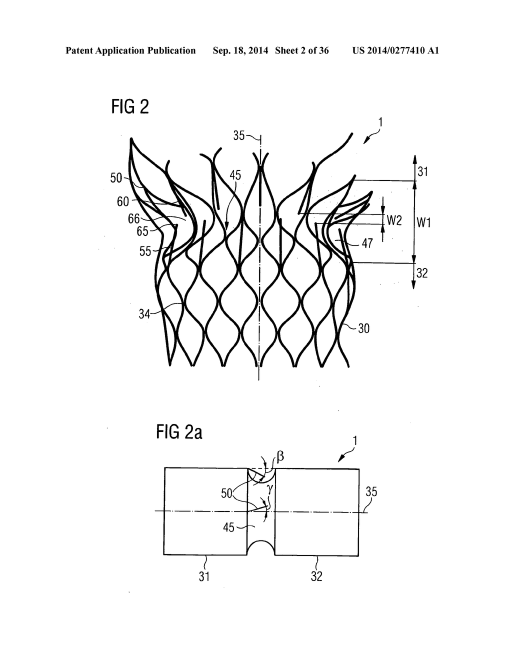 TRANSCATHETER VALVE PROSTHESIS - diagram, schematic, and image 03