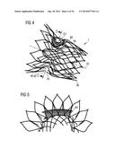 TRANSCATHETER VALVE PROSTHESIS diagram and image