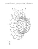 TRANSCATHETER VALVE PROSTHESIS diagram and image