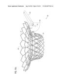 TRANSCATHETER VALVE PROSTHESIS diagram and image