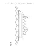 TRANSCATHETER VALVE PROSTHESIS diagram and image