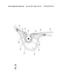 TRANSCATHETER VALVE PROSTHESIS diagram and image