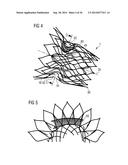 TRANSCATHETER VALVE PROSTHESIS diagram and image