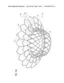 TRANSCATHETER VALVE PROSTHESIS diagram and image