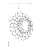 TRANSCATHETER VALVE PROSTHESIS diagram and image