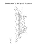 TRANSCATHETER VALVE PROSTHESIS diagram and image