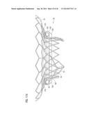 TRANSCATHETER VALVE PROSTHESIS diagram and image