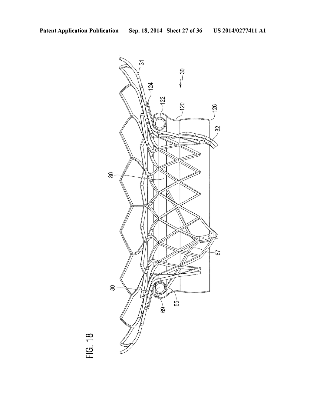 TRANSCATHETER VALVE PROSTHESIS - diagram, schematic, and image 28