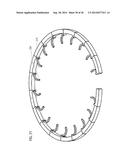 TRANSCATHETER VALVE PROSTHESIS diagram and image