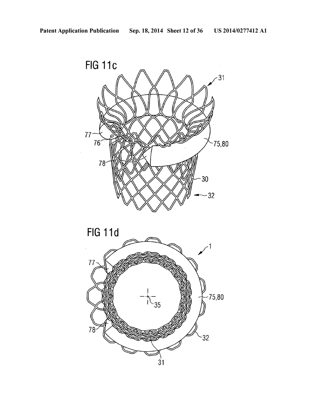 TRANSCATHETER VALVE PROSTHESIS - diagram, schematic, and image 13