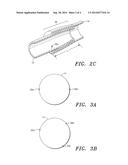 Seamless Tubular Extracellular Matrix Prosthetic Valve and Method for     Forming Same diagram and image