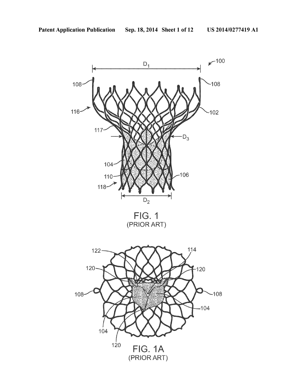 Anti-Paravalvular Leakage Component for a Transcatheter Valve Prosthesis - diagram, schematic, and image 02