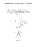 Anti-Paravalvular Leakage Component for a Transcatheter Valve Prosthesis diagram and image