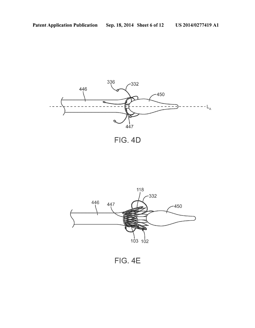 Anti-Paravalvular Leakage Component for a Transcatheter Valve Prosthesis - diagram, schematic, and image 07