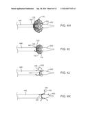 Anti-Paravalvular Leakage Component for a Transcatheter Valve Prosthesis diagram and image