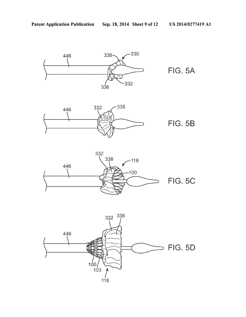 Anti-Paravalvular Leakage Component for a Transcatheter Valve Prosthesis - diagram, schematic, and image 10