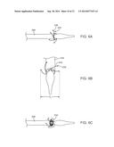 Anti-Paravalvular Leakage Component for a Transcatheter Valve Prosthesis diagram and image