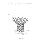 Anti-Paravalvular Leakage Component for a Transcatheter Valve Prosthesis diagram and image