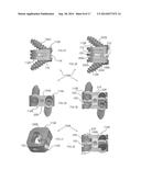 Expandable Intervertebral Implant diagram and image