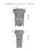 Expandable Intervertebral Implant diagram and image