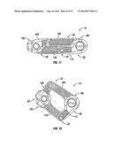 Expandable Interbody Spacer diagram and image