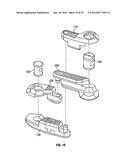 Expandable Interbody Spacer diagram and image