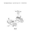 Expandable Interbody Spacer diagram and image