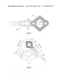 Expandable Interbody Spacer diagram and image