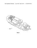 Expandable Interbody Spacer diagram and image