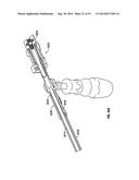 Expandable Interbody Spacer diagram and image