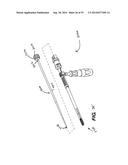 Expandable Interbody Spacer diagram and image