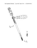 Expandable Interbody Spacer diagram and image