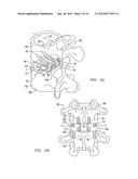 POSTERIOR SPINAL IMPLANT SYSTEM diagram and image