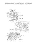 POSTERIOR SPINAL IMPLANT SYSTEM diagram and image