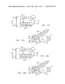 POSTERIOR SPINAL IMPLANT SYSTEM diagram and image