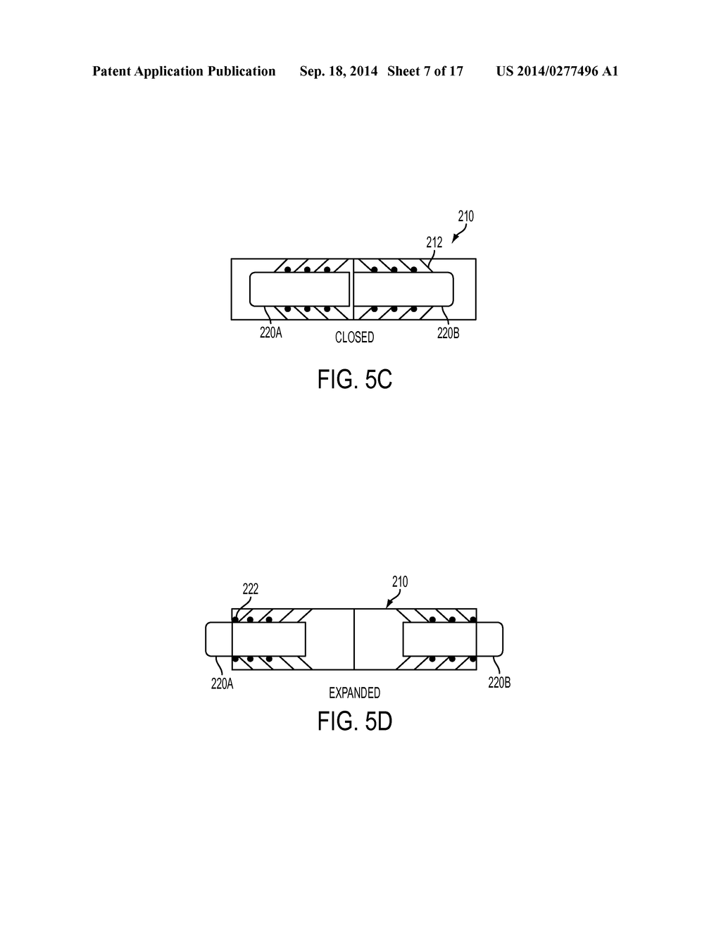 EXPANDABLE DEVICE FOR IMPLANTATION IN BODY SPACE - diagram, schematic, and image 08